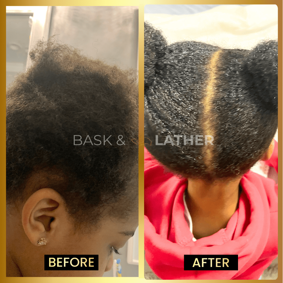 BALM - Stimulating Scalp and Hair Balm - Image 4