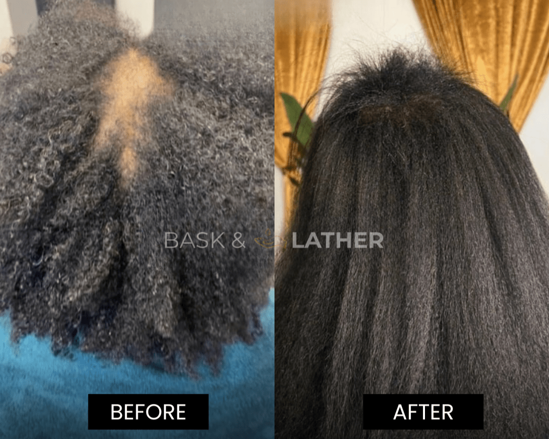 XL Cleanse and Growth Bundle - For Moisture & Hydration - Image 2