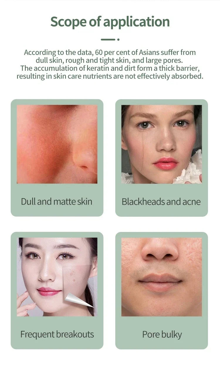 Blackhead Remover - Image 11