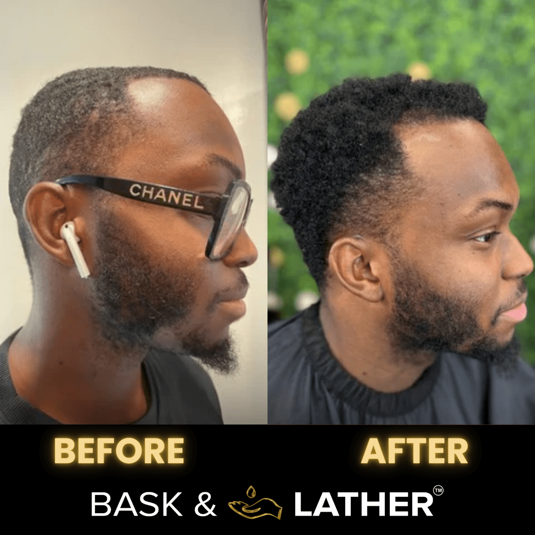 Men’s Healthy Hair and Beard Starter Kit - Image 3